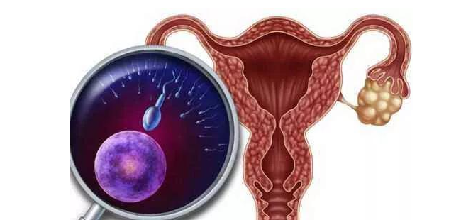 饮食干预：预防子宫内膜癌，从餐桌做起