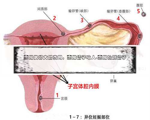 惠州供卵大概费用，惠州精子呛人,惠州检测精子