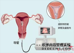 中国做试管代孕的要求-试管代孕如何助孕_专业供卵试管生子中心-供卵机构包男