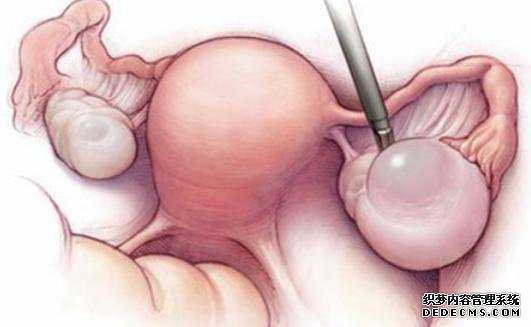 中国供卵试管价格-试管代孕真实情况_哪有愿意供卵试管的个人-试管代孕找子宫