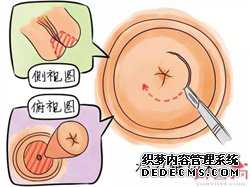 珠海供卵试管帮忙生小孩-珠海代怀中心北京代孕价格